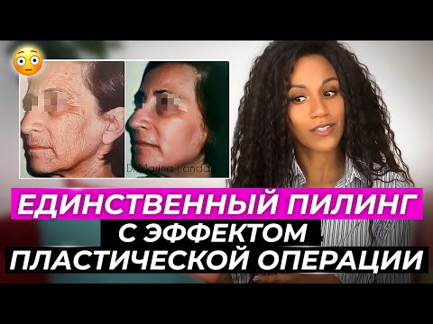 Видео: Невероятные результаты пилинга // Процедура для омоложения // Минус 20 лет