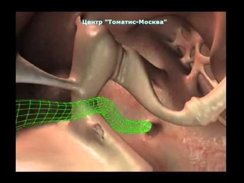 Видео: Работа слуховой системы