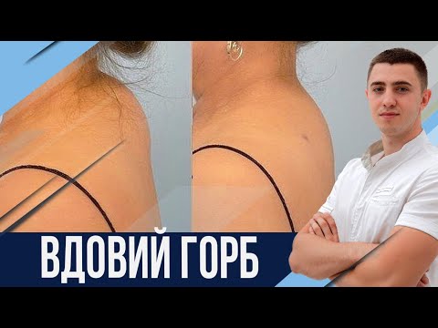 Видео: Холка. Как можно дома ее убрать?