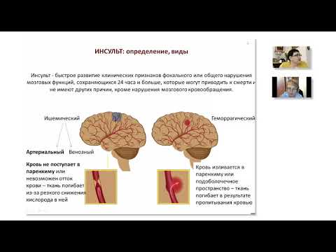 Видео: Школа клинического мышления педиатра. Артериальный ишемический инсульт у детей
