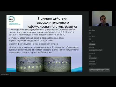 Видео: ULTRAFORMER. Секреты успеха для создания индивидуального протокола при работе со "сложным" пациентом