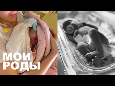 Видео: МОИ РОДЫ | ПО ОМС В 67 ПЕРИНАТАЛЬНОМ ЦЕНТРЕ