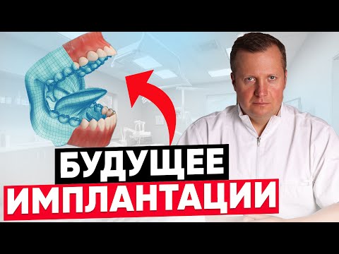 Видео: Как ИДЕАЛЬНО поставить имплант ? Цифровой протокол в действии