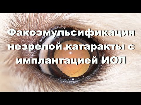 Видео: Факоэмульсификация незрелой катаракты у собаки с имплантацией ИОЛ