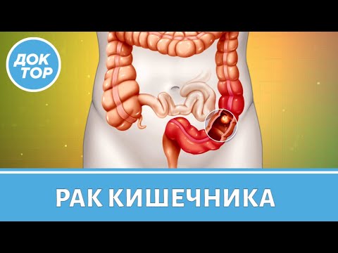 Видео: Колопроктолог Бадма Башанкаев рассказывает про рак кишечника