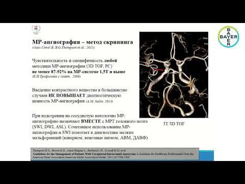 Видео: КТ ангиография интракраниальных артерий