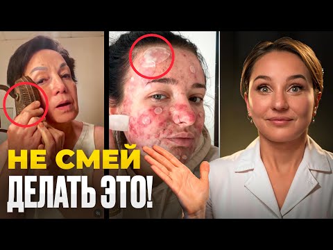 Видео: Эти TikTok «лайфхаки» КАЛЕЧАТ кожу. Косметологи бьют тревогу!
