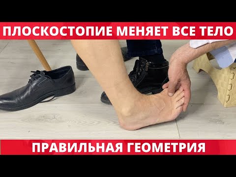 Видео: Геометрия ног, плоскостопие меняет все тело | Школа Ног