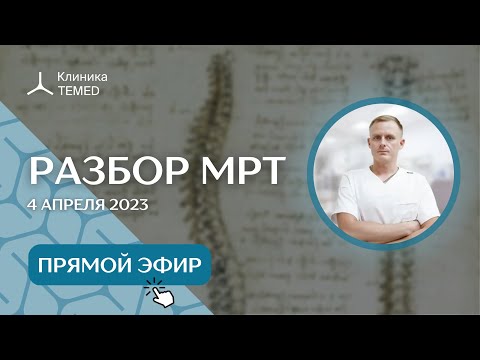 Видео: Разбор МРТ (4.04.23)