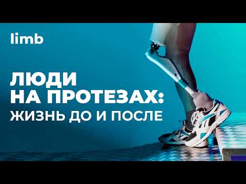 Видео: Как живут люди с протезами? История о сложностях протезирования и жизни после ампутации