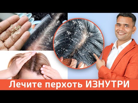 Видео: ЛЕЧЕНИЕ ПЕРХОТИ БЕЗ ШАМПУНЕЙ.