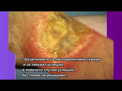 Видео: Базалиомите  - късо учебно видео