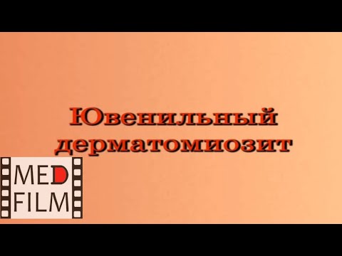 Видео: Ювенильный дерматомиозит © juvenile dermatomyositis