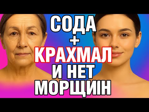 Видео: СОДА+КРАХМАЛ  Мгновенно омолодили кожу лица в 70 лет ! ЧУДО МАСКА от морщин