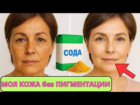 Видео: СОДА + КУРКУМА  в 70 лет СТЁРЛИ ВСЕ МОРЩИНЫ ! Наношу на ночь — утром кожа гладкая, как в 30!
