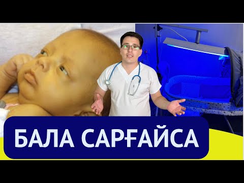 Видео: Бала сарғаюы// желтуха //#сарғыштық #сарғаю #фотолампа