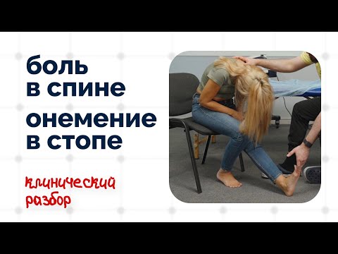 Видео: Боль в спине и онемение стоп | Клинический разбор