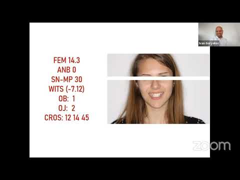 Видео: Последователи на дисциплината "Алекзандър" - епизод 10: д-р Катя Иванова