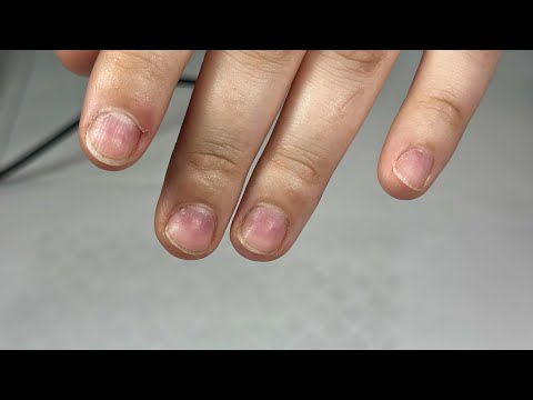 Видео: КОРРЕКЦИЯ НОГТЕЙ. Виктория Авдеева