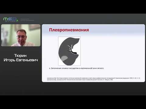 Видео: Консолидация в легких Тюрин Игорь Евгеньевич