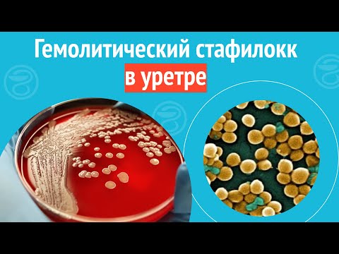 Видео: ☹ Гемолитический стафилокк в уретре. Клинический случай №1098