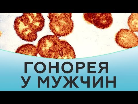 Видео: Гонорея у мужчин. Лечение гонореи