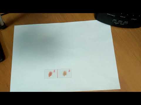 Видео: Определение групп Крови по системе Ландштейнера AB0