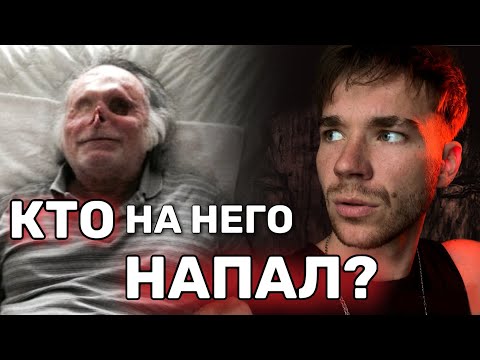 Видео: Потерял ЛИЦО после НАПАДЕНИЯ.😱 Жуткие истории.