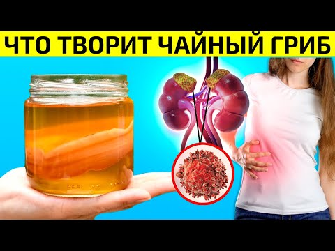 Видео: Этот Напиток Здоровья ШОКИРУЕТ даже ВРАЧЕЙ! Чайный Гриб Польза и Вред. Как Приготовить Чайный Гриб