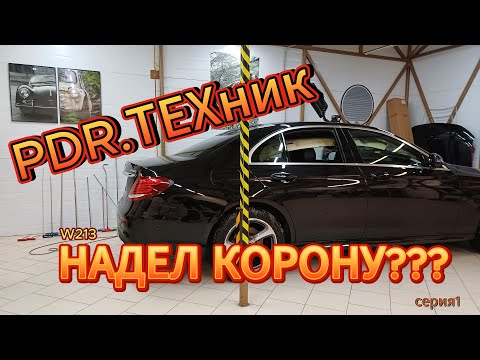 Видео: Короны Крауны Выпуклости 1Серия