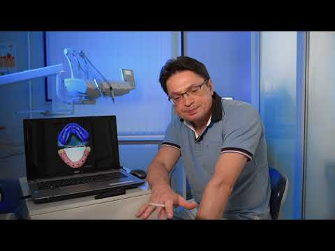 Видео: Клинический пример тотального протезирования с использованием имплантатов (циркониевая подкова)