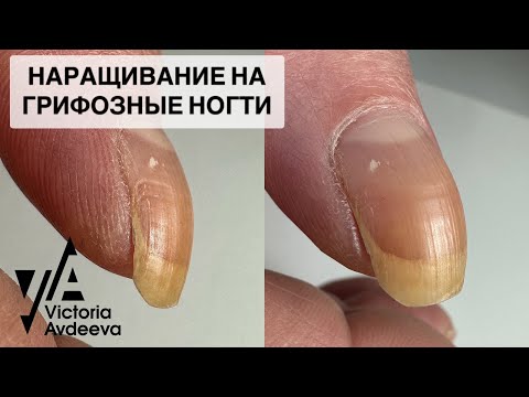 Видео: НАРАЩИВАНИЕ НА ГРИФОЗНЫЕ НОГТИ. МАНИКЮР ОНЛАЙН. Виктория Авдеева