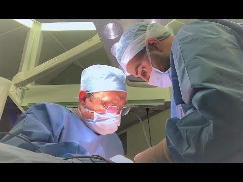 Видео: Удаление срединной кисты шеи. Резекция тела подъязычной кости.