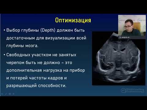 Видео: «Оптимизация изображения и возможности визуализации мозжечка  Оценка кровоизлияний в мозжечок»