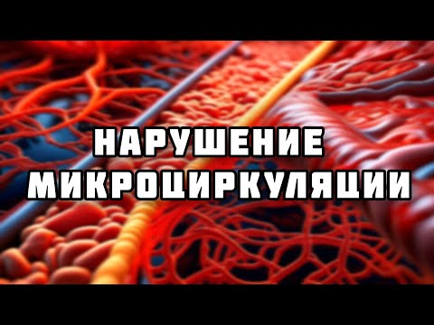 Видео: Нарушение микроциркуляции // Патофизиология (2 тема)