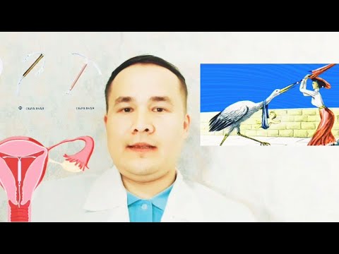 Видео: Спирал хақида бафуржа маълумот ( Бачадон ички воситаси)