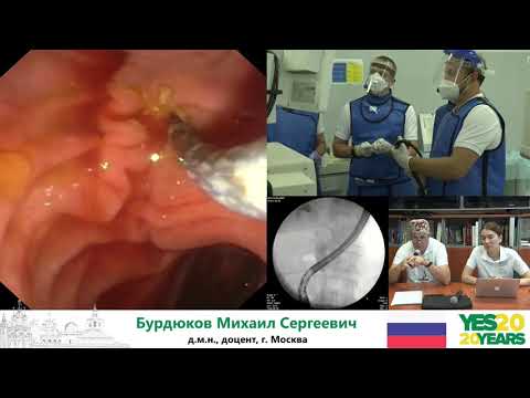 Видео: 31. ЭРХПГ-стентирование.  М. С. Бурдюков, Д. В.  Гусев
