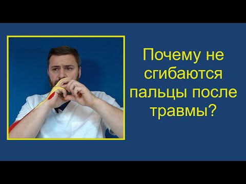 Видео: Почему не сгибаются пальцы кисти после травмы и как себе помочь?