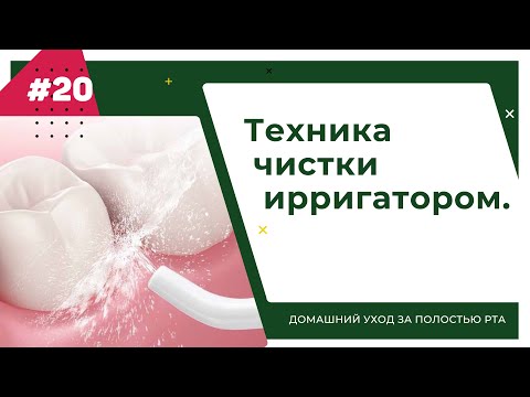 Видео: Техника чистки ирригатором. Урок №20 - ДОМАШНИЙ УХОД ЗА ПОЛОСТЬЮ РТА.