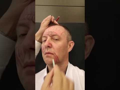 Видео: Диспорт для мужчин: исследование единиц
