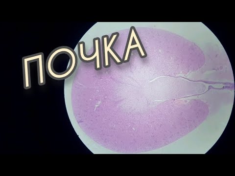 Видео: ПОЧКА