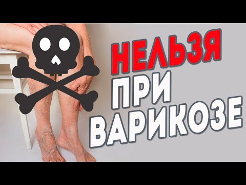 Видео: Что нельзя делать при варикозе?