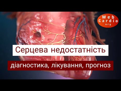 Видео: Серцева недостатність: діагностика, лікування, прогноз за рекомендаціями ESC та АСС/АНА 2021-2022.