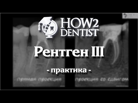 Видео: Как правильно делать прицельные снимки / How to Dentist