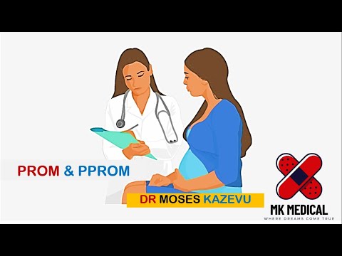 Видео: Преждевременный разрыв плодных оболочек (ПРПО)