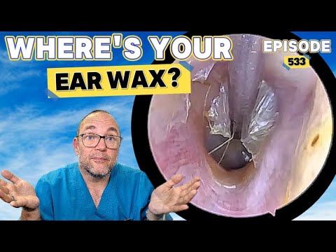 Видео: ГДЕ ТВОЯ УШНАЯ СЕРА? Выпуск 533