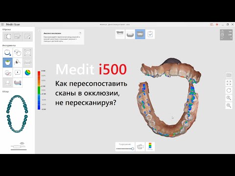 Видео: Medit i500 - Как пересопоставить сканы в окклюзии, не пересканируя?