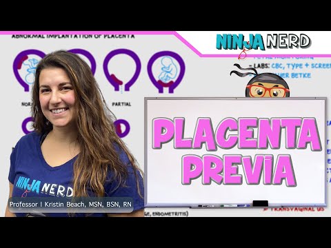 Видео: Предлежание плаценты