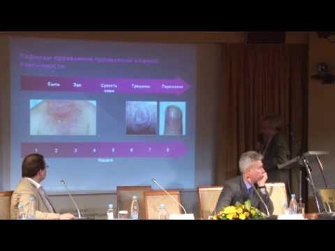 Видео: Кожная токсичность современной таргетной терапии