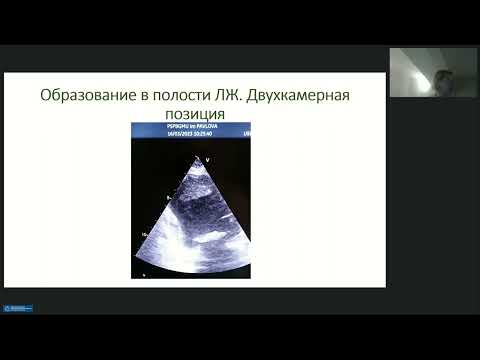 Видео: Редкие клинические случаи при ультразвуковой диагностике